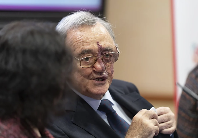 Avviata una campagna di raccolta fondi per sostenere la scoperta spagnola nella ricerca sul cancro al pancreas