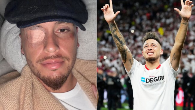Il giocatore del Monterrey Lucas Ocampos soffre di paralisi facciale causata da un virus; I fan si divertono con i meme