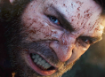 Marvel's Wolverine attore ha studiato cani rabbiosi per interpretare un Logan pi&ugrave; selvatico