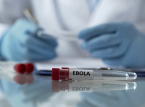 L'OMS sostiene che l'epidemia di Ebola in Congo abbia il maggior numero di casi confermati nel primo mese fino ad oggi