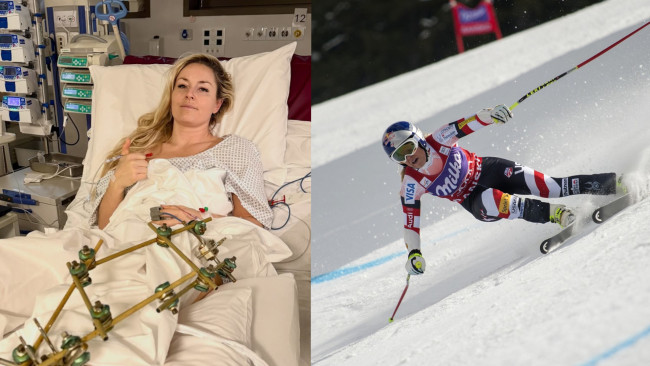 La sciatrice americana Lindsey Vonn si sottopone al terzo intervento chirurgico alla gamba